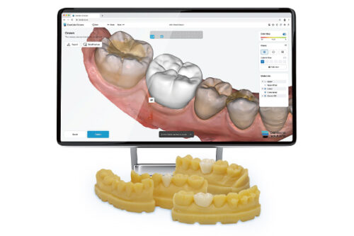 Dentbird Solutions